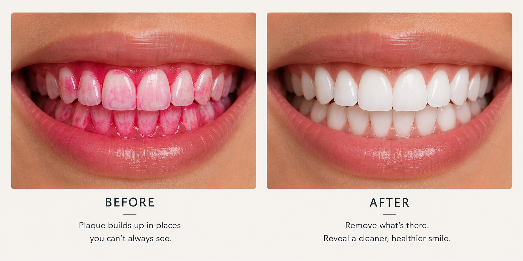 Before and after using Enamely Plaque Check — plaque revealed in pink, then a clean smile
